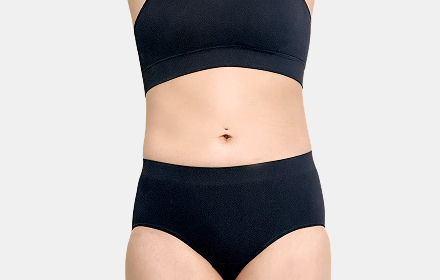 VASER Liposuction before — abdomen · case 1, De:light Gangnam