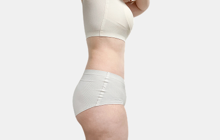 VASER Liposuction after — abdomen · case 3, De:light Gangnam