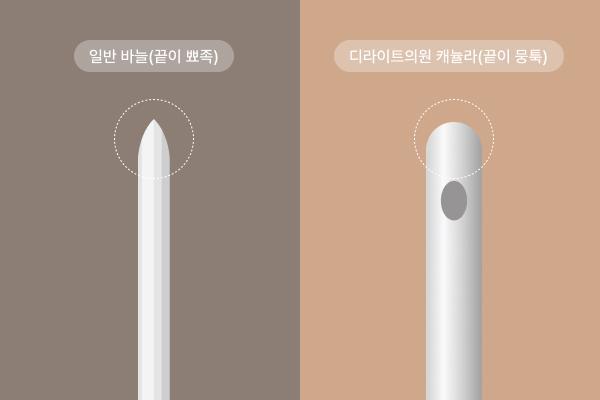 지방흡입시스템