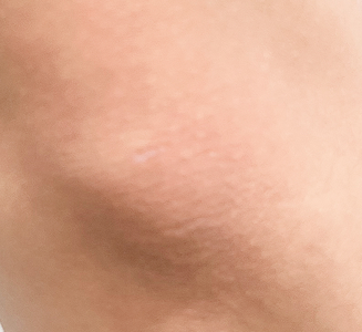 디라이트기술