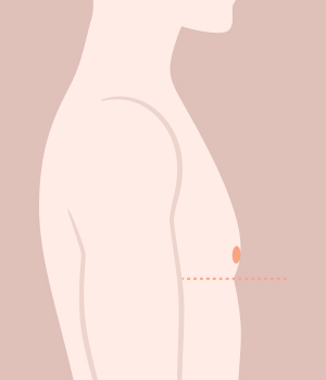 디라이트기술