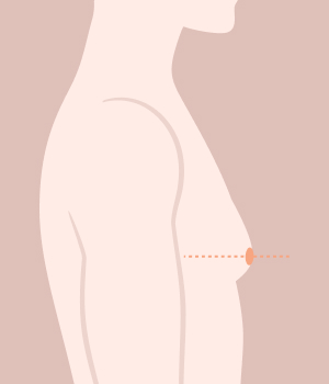 디라이트기술
