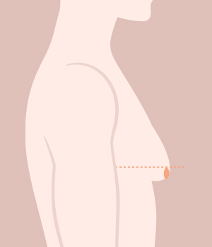 디라이트기술