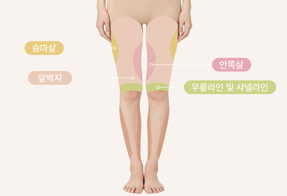 허벅지/종아리 지방흡입 부위