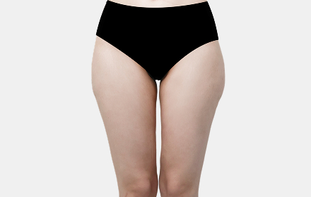 Thigh Liposuction before — case 1, De:light Gangnam