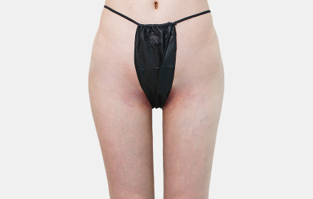 Thigh Liposuction after — case 3, De:light Gangnam